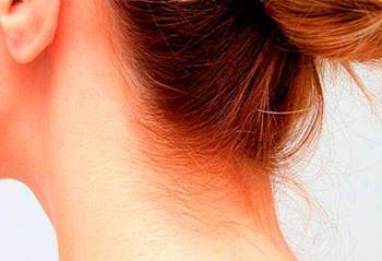 bg coloracion rojos imagen2